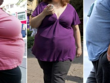 La obesidad, un factor de riesgo en el COVID-19, según un asesor francés